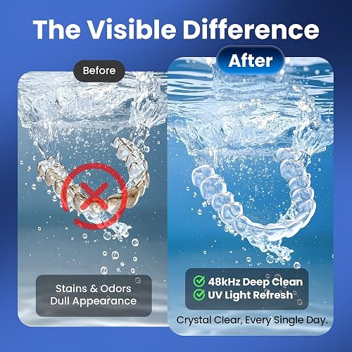 Manufacturer before-and-after graphic contrasting a stained aligner with a clear one after ultrasonic and UV cleaning