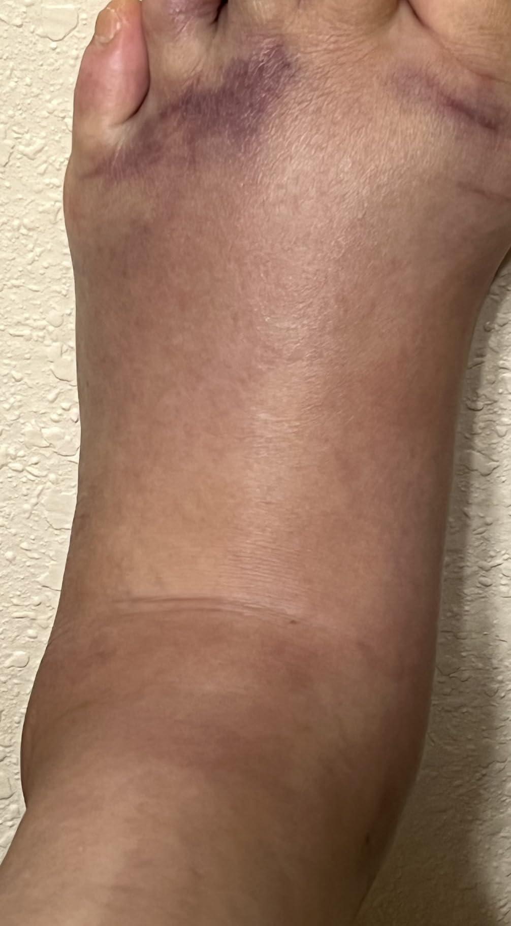 TheraICE ankle wrap demonstrating the slip-on design