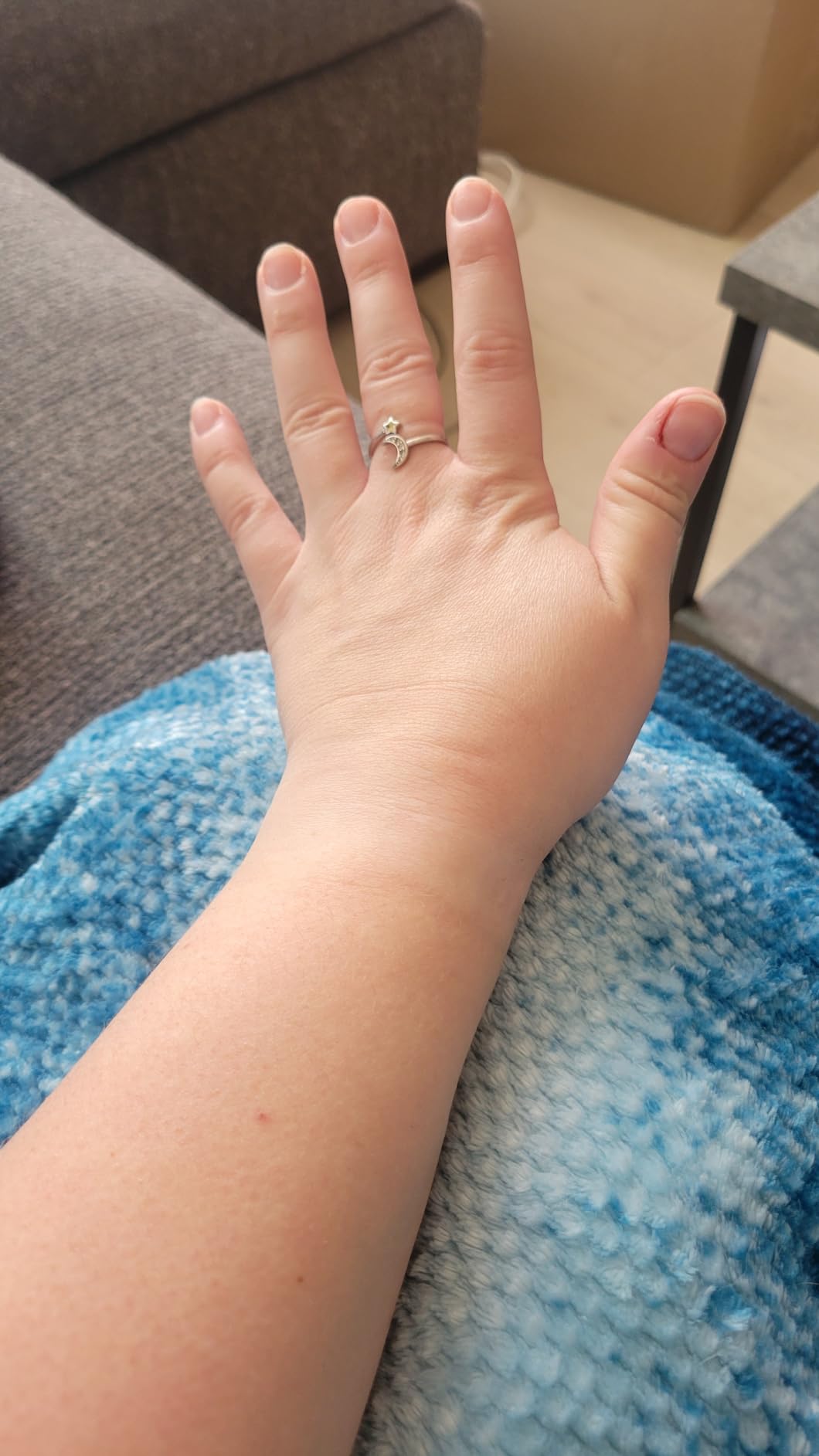 Customer photo showing TheraICE elbow sleeve being worn